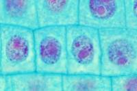 Cellules de racine d'Ail  en mitose - cellules-filles en interphase x 600